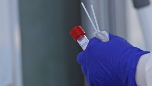СКОК ПРЕГЛЕДА НА КОРОНА ВИРУС: Најновији епидемиолошки пресек за Златиборски округ