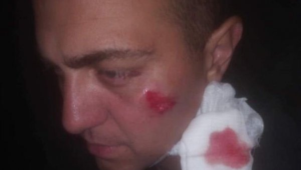 УЗНЕМИРУЈУЋЕ: Погледајте слике рањених полицајаца које су синоћ напали хулигани (ФОТО)