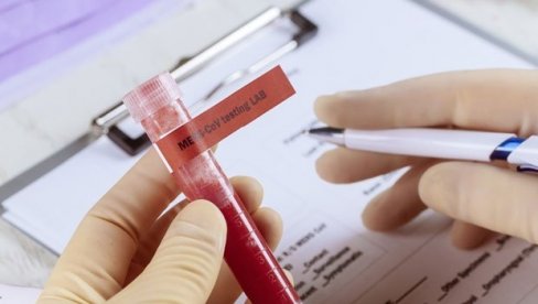У РУСИЈИ више од 24 милиона тестирања на вирус корона