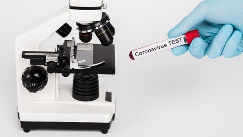 INTERPOL: Zaplenjeno 17.000 lažnih testova za korona virus