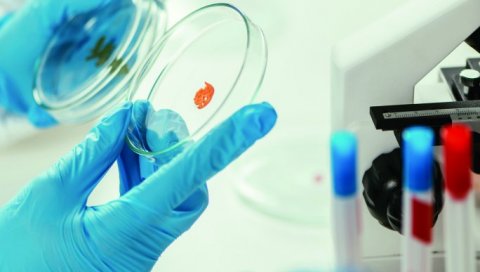 БИОСЕНЗОР ОТКРИВА ЗЛОЋУДНЕ ЋЕЛИЈЕ: Институт за молекуларну генетику у Београду развија алат за рано откривање канцера дебелог црева