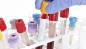 ZAMENA ZA PCR? Farmaceuti otkrili novi način testiranja na virus korona