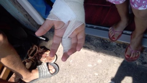 УЖАС У КРУШЕВЦУ! ДЕЧАК ЗАДОБИО ПОВРЕДЕ ГЛАВЕ: Његовој сестри рука завијена након активирања експлозивне направе