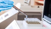 REZULTAT ZA POLA SATA Sve o antigenskom testu koji od danas počinje da se primenjuje u Srbiji