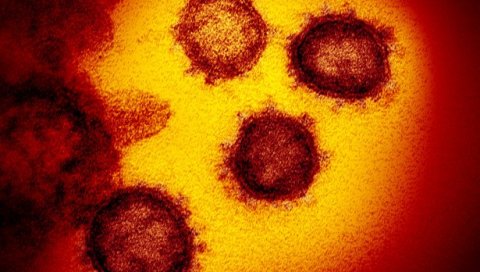 ПРЕМА ПОСЛЕДЊИМ ПОДАЦИМА:  Број заражених корона вирусом у свету премашио 66 милиона