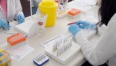 БЕЗ ЗАКАЗИВАЊА ТЕРМИНА: Завод почео анализе на присуство антитела на вирус корона