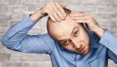 5 stvari koje su potrebne kosi da bi blistala