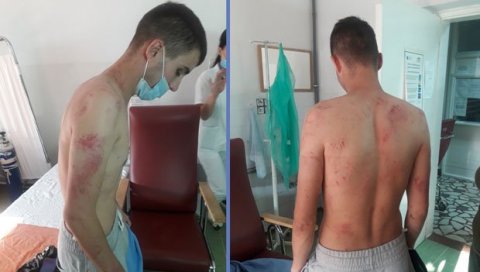 БАТИНАЊE ЗБОГ ПОЗИВA НА СЕКС: Полицајац Драгомир Фимић заобишао институције и претукао Миодрага Звијера из Билеће