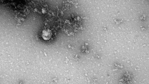 ANALIZE KAŽU DA NIJE ZARAZNIJI: Otkriven novi soj virusa korona  u Bretanji