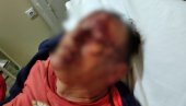 HOROR KOD MALOG ZVORNIKA: Tri muškarca brutalno pretukla Mlađa Tomića, nesrećni čovek u teškom stanju (UZNEMIRUJUĆI FOTO)