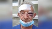 ДЕТАЉИ БАТИНАЊА: Младић (28) пребио комшију Милорада (69) - несрећни човек му приговорио због нелегалне градње