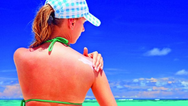 Опасне последице неодговорног сунчања!