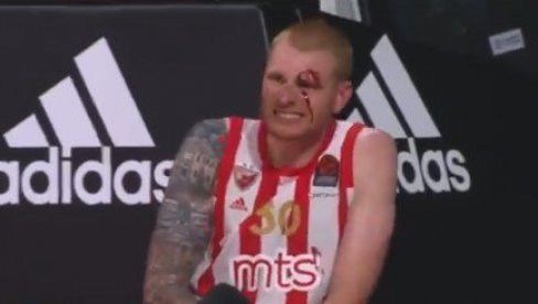 VAJTA ČEKA DUGA PAUZA: Evo koliko će košarkaš Zvezde odsustvovati sa parketa (VIDEO)