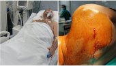 PRVE FOTOGRAFIJE SRBINA KOG SU UPUCALI ALBANCI: Srećko u bolnici nakon što su ga ustrelili u leđa (UZNEMIRUJUĆI FOTO)