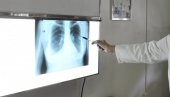 SRBIJA PRVA MEĐU DRŽAVAMA ZAPADNOG BALKANA: Uveden skrining program za rano otkrivanje raka pluća