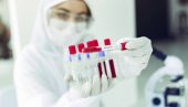 RUSI TESTIRAJU LEK PROTIV KORONE: Mir-19 sprečava razmnožavanje virusa i najteže oblike bolesti