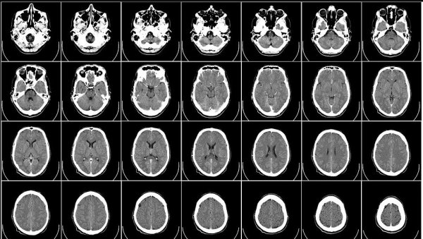 МОЗАК МОДЕРНИХ ЉУДИ СЕ МАЊУЈЕ: Студија открила невероватне податке - стигло и упозорење научника