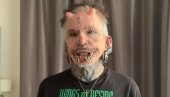 I ON JE GINISOV REKORDER: Nemac 20 godina tetovira telo i stavlja pirsinge, „navučen“ na ukrašavanje, ugradio i implante – rogove (VIDEO)