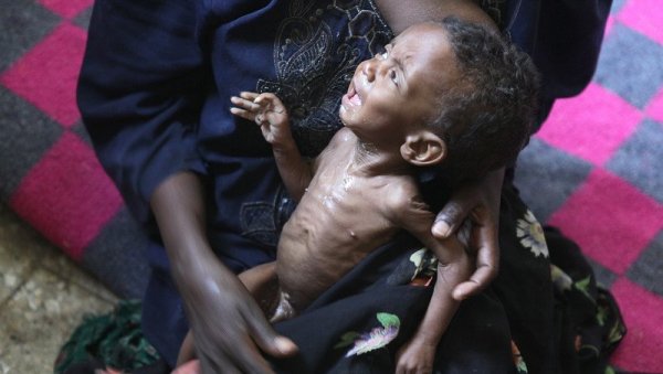 НОВА ПОРАЖАВАЈУЋА ПРОЦЕНА ЕУ: У Етиопији је гладно девет милиона људи! (ВИДЕО)