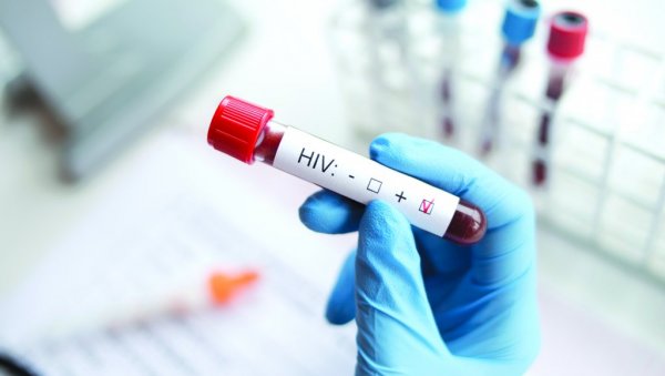 ПОРАЖАВАЈУЋА СТАТИСТИКА: Све већи број недијагностификованих случајева ХИВ-а у Европи