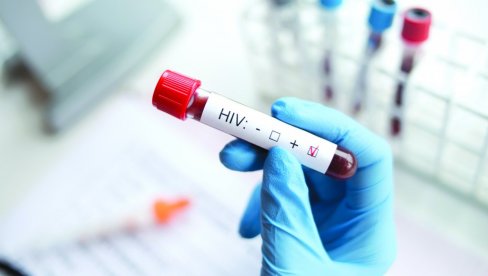 PORAŽAVAJUĆA STATISTIKA: Sve veći broj nedijagnostifikovanih slučajeva HIV-a u Evropi