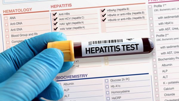 ПРЕВЕНТИВНИ ПРОГРАМ БАТУТА: У свим заводима бесплатно тестирање на Б и Ц хепатитис