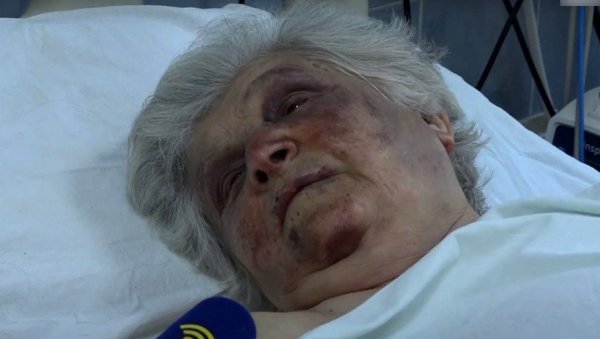 ЧУПАЛИ СУ МЕ И ГЛАВОМ МИ УДАРАЛИ О ПОД: Бака Божана из Северне Митровице у болници након стравичног напада (ВИДЕО)