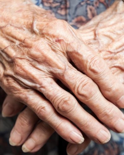 STOGODIŠNJACI KAO MLADIĆI: Otkriće istraživača u Ženevi i Lozani