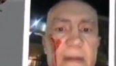 Na proteste poziva i Šabić - čovek koji je izmislio da je napadnut (VIDEO)