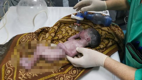 ФЛОТИЛУ „БИС“ ОД 9 ЧАМАЦА ЗАУСТАВИО ЈЕ ИЗРАЕЛ: На њима било и 10 Италијана, лекара и медицинских сестара, носили су помоћ Гази