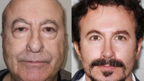 ИЗГЛЕДА 30 ГОДИНА МЛАЂЕ Невероватна трансформација након пластичне операције у Турској, пљуште коментари (ФОТО)