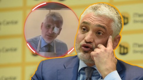 ЧЕДА ПОНОВО ПОВРЕЂЕН Овај пут страдало око: Све мора да се плати (ВИДЕО)