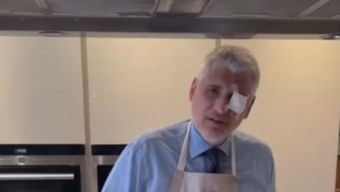 ЗАТВОРЕНО: Откривено како је Чеди Јовановићу страдало око