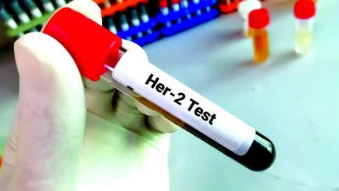 ŠANSA KOD NAJTEŽEG OBLIKA BOLESTI: Odobren ribociklib za lečenje raka dojke