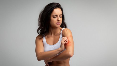 Како неговати кожу склону екцему и да ли је пилинг за тело безбедан избор?