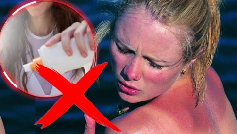 Жени (48) ПУКЛА КОСТ због креме за сунчање! Ово је УПОЗОРЕЊЕ за све