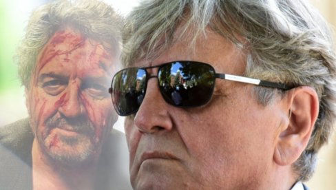 ХОРОР Радош Бајић објавио слику - сав крвав: Безброј пута сам био у ранама (ФОТО)