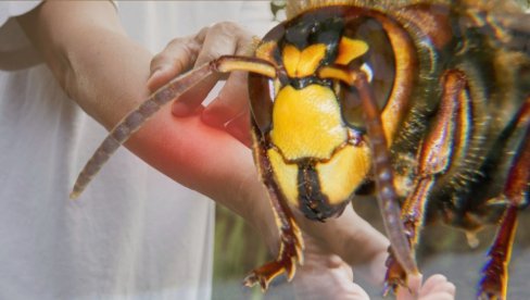 ŠTA AKO VAS UBODE STRŠLJEN: Postupak koji može spasiti život