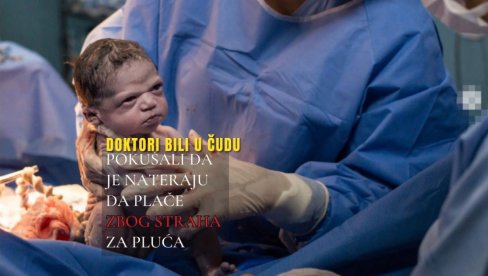О БЕСНОЈ БЕБИ ПРИЧАО СВЕТ - ВИДИТЕ ЈЕ САД: Доктори били у чуду - покушали да је расплачу, да виде раде ли јој плућа (ФОТО)