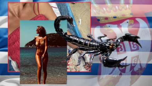 УТРНУТА САМ: Српску водитељку ујела шкорпија на летовању у Грчкој - хитно пребачена у болницу (ФОТО)