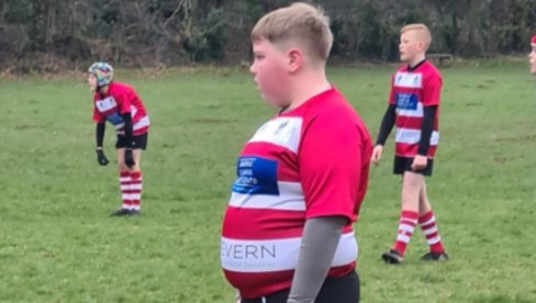 DEČAKA SU ISMEJAVALI ZBOG GOJAZNOSTI... A onda se desilo nešto neverovatno