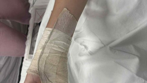 DEČAKU (14) IZ NIŠA AMPUTIRAN DEO PRSTA: Majka tvrdi da su ga šipkom pretukla četvorica maloletnika