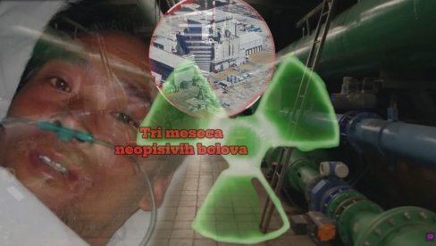 НАЈБОЛНИЈА СМРТ У ИСТОРИЈИ: Плакао крв после нуклеарне катастрофе, молио докторе да га пусте да умре - ТРИ МЕСЕЦА агоније