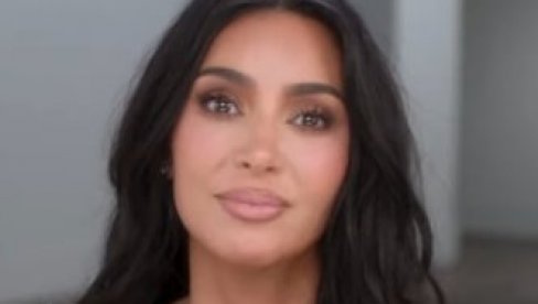 KIM KARDAŠIJAN IMA ANEURIZMU MOZGA: Preživeli kažu da je ovo najjači bol u životu, a prvi simptom je glavobolja!