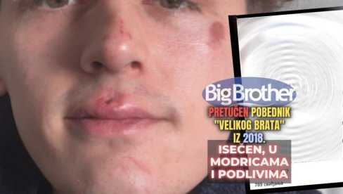 BRUTALNO PRETUČEN POBEDNIK VELIKOG BRATA Politika, vlada, ljudi — žele da nas podele, ali oni neće pobediti