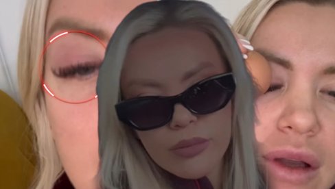 ВОДИТЕЉКИ ЗАТВОРЕНО ОКО: Баш је страшно, баш ме боли (ФОТО)