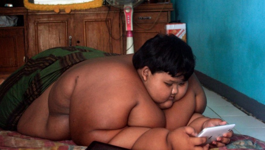 IMAO JE 192 KILOGRAMA: Bio najdeblji dečak na svetu - a danas je neprepoznatljiv (VIDEO)