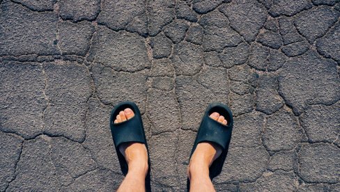 ŠTA VAM TELO PORUČUJE? Ispucale pete mogu ukazivati na probleme sa štitnom žlezdom