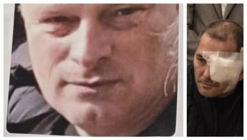 UHAPŠEN BLOKADER: Priveden napadač na Vladimira Marjanovića