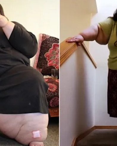 ИМАЛА СКОРО 300 КГ, НИЈЕ МОГЛА ДА ХОДА: Данас игледа сјајно - а на интенету је прати више од 400 хиљада људи! (ФОТО)